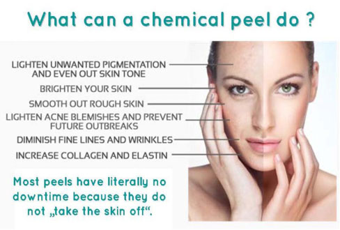 Chemical Peels