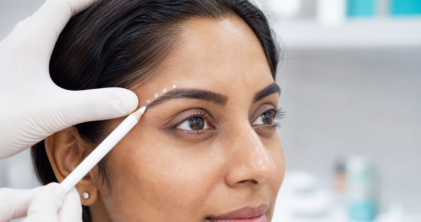 Brow Lift Botox